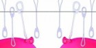 100 Dekofix Verschl�sse